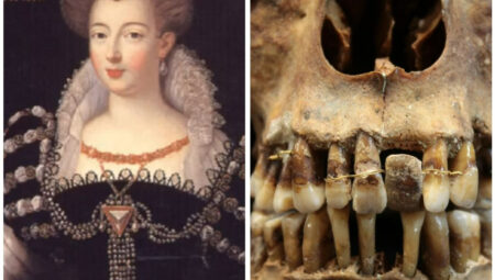 Fransız aristokratın dişlerindeki sır, ölümünden 400 yıl sonra çözüldü